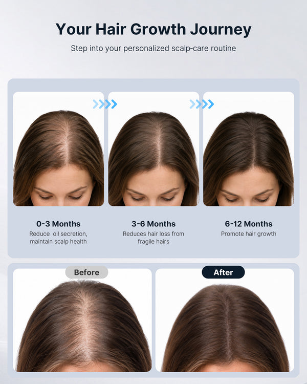 LS-D651 Precision Laser Hair Growth & Massage Comb