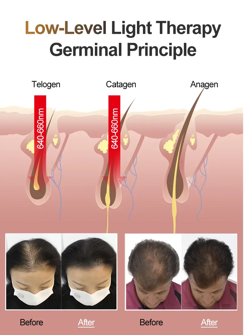 regrow hair
