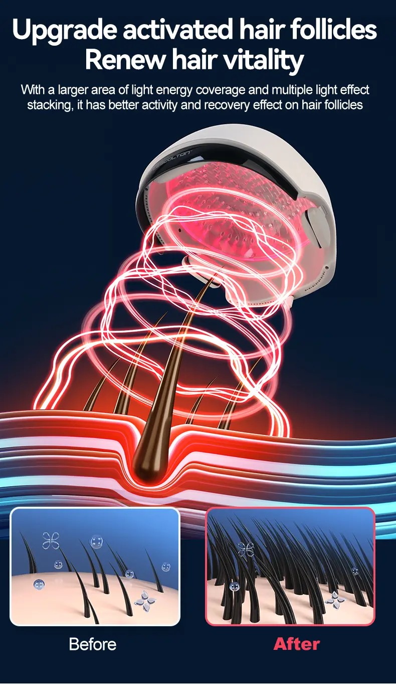 laser helmet for hair growth supplier