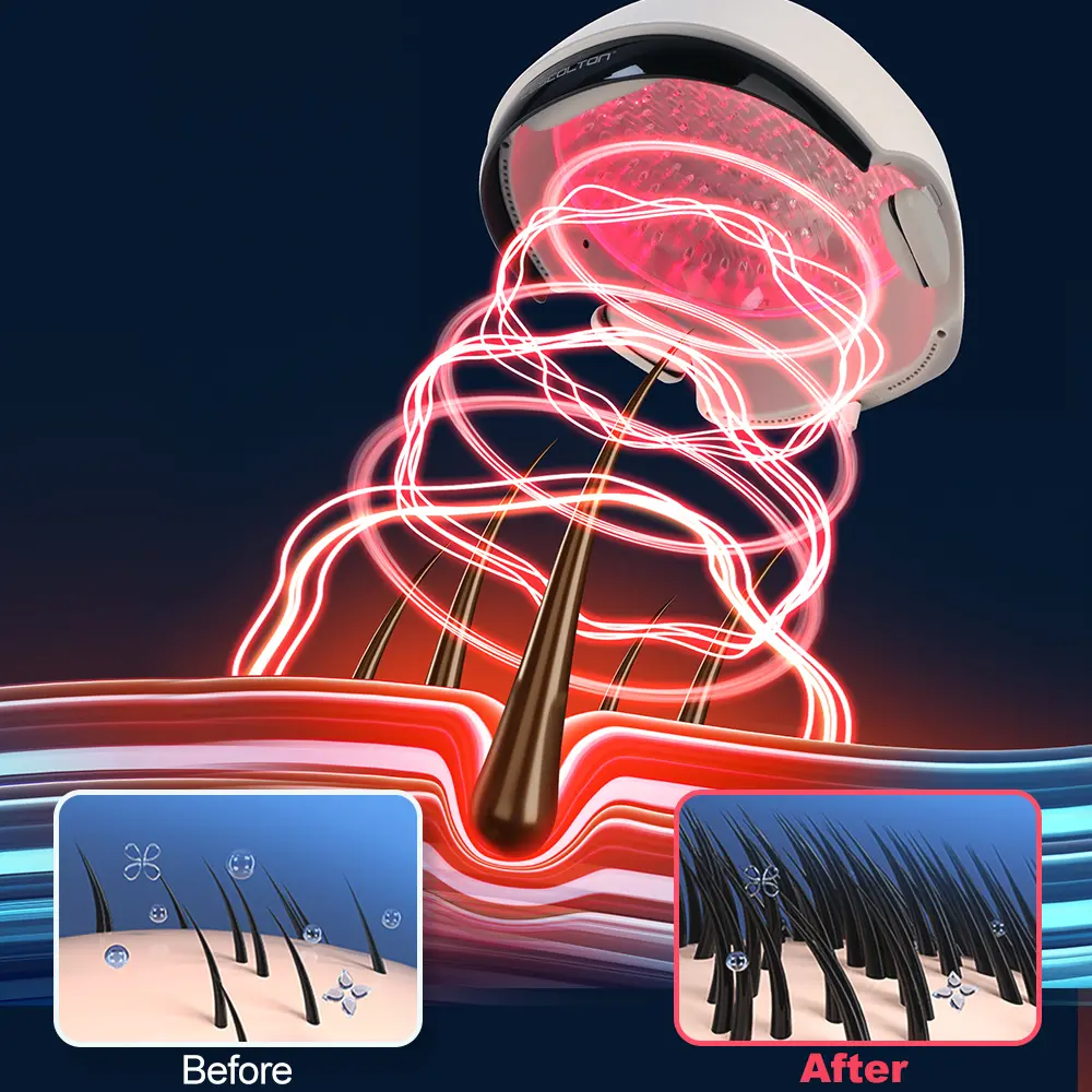 hair regrowth for men