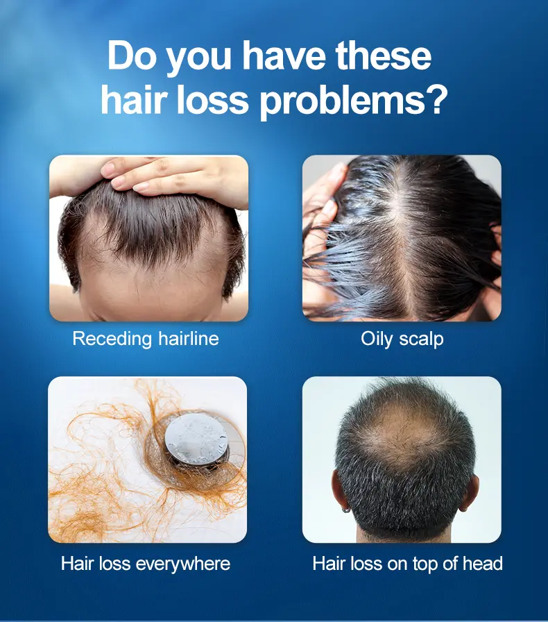 hair loss
