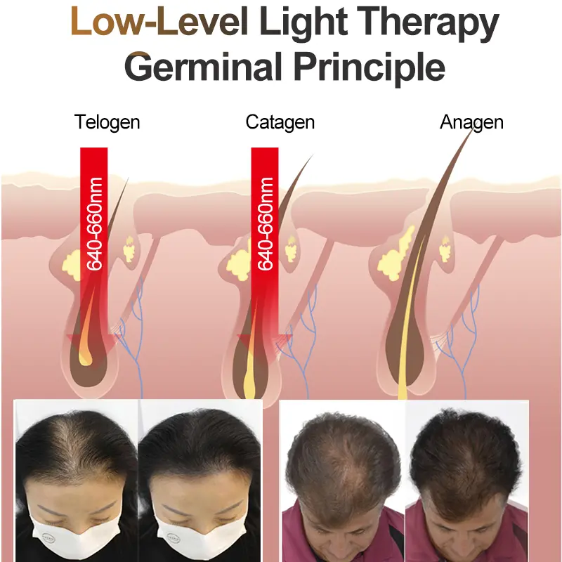 hair loss treatment
