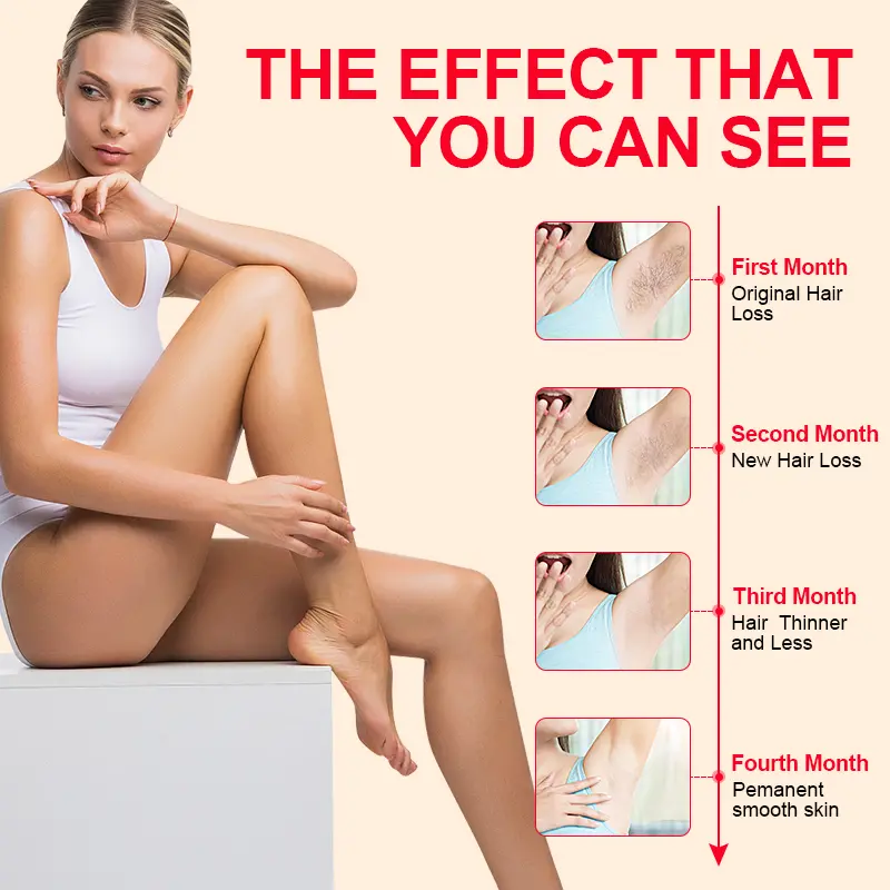 IPL hair removal