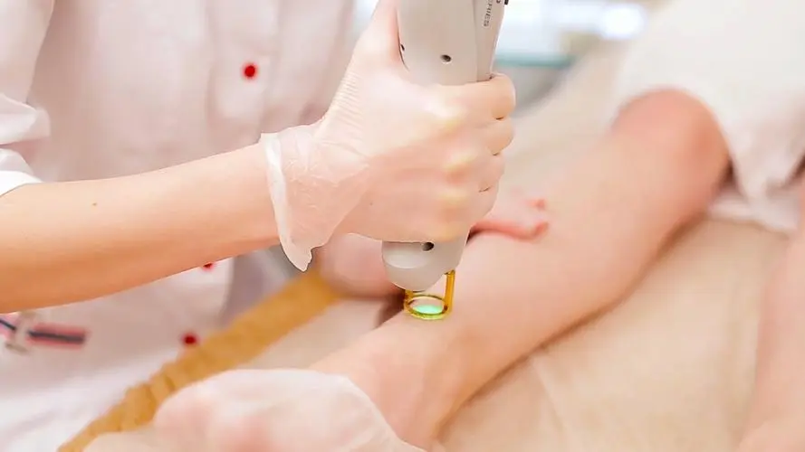 hair removal for women