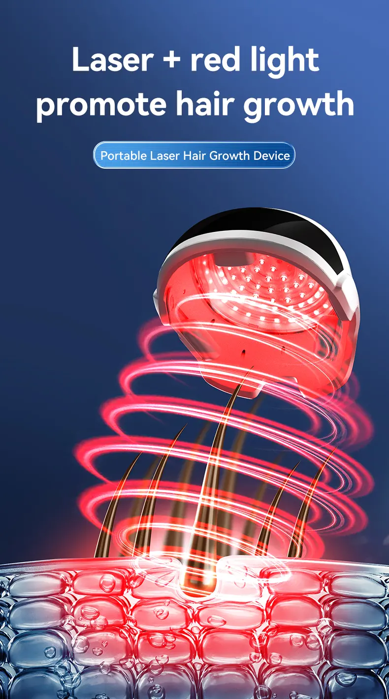 laser cap for hair loss