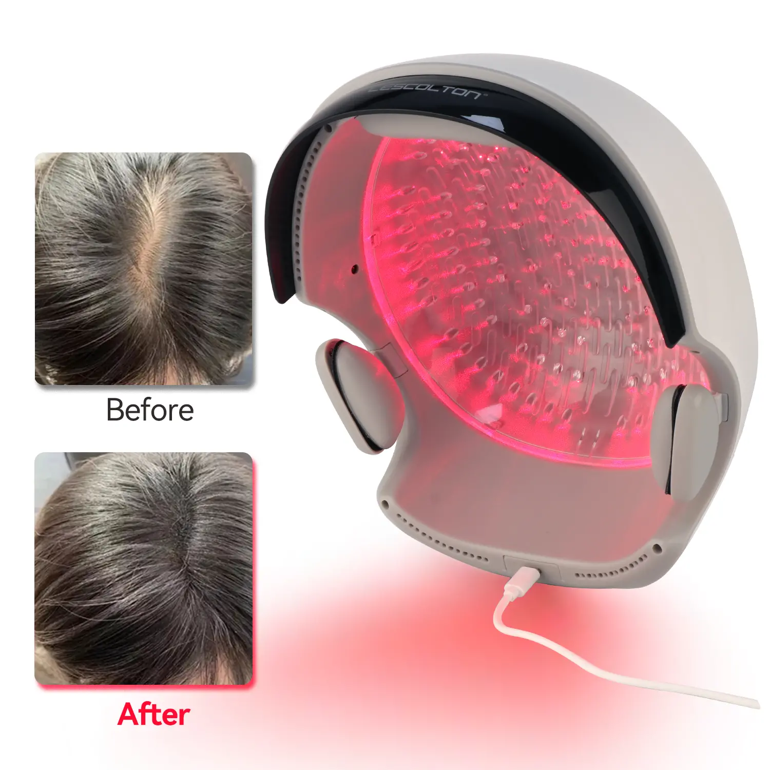 Best Laser Caps for Hair Loss manufacturer