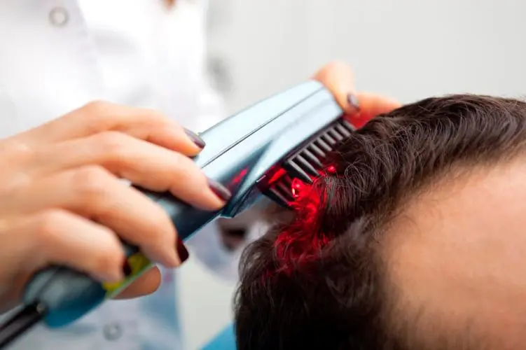 hair loss laser treatment