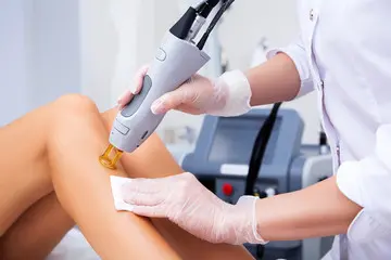 appareil d'épilation en gros