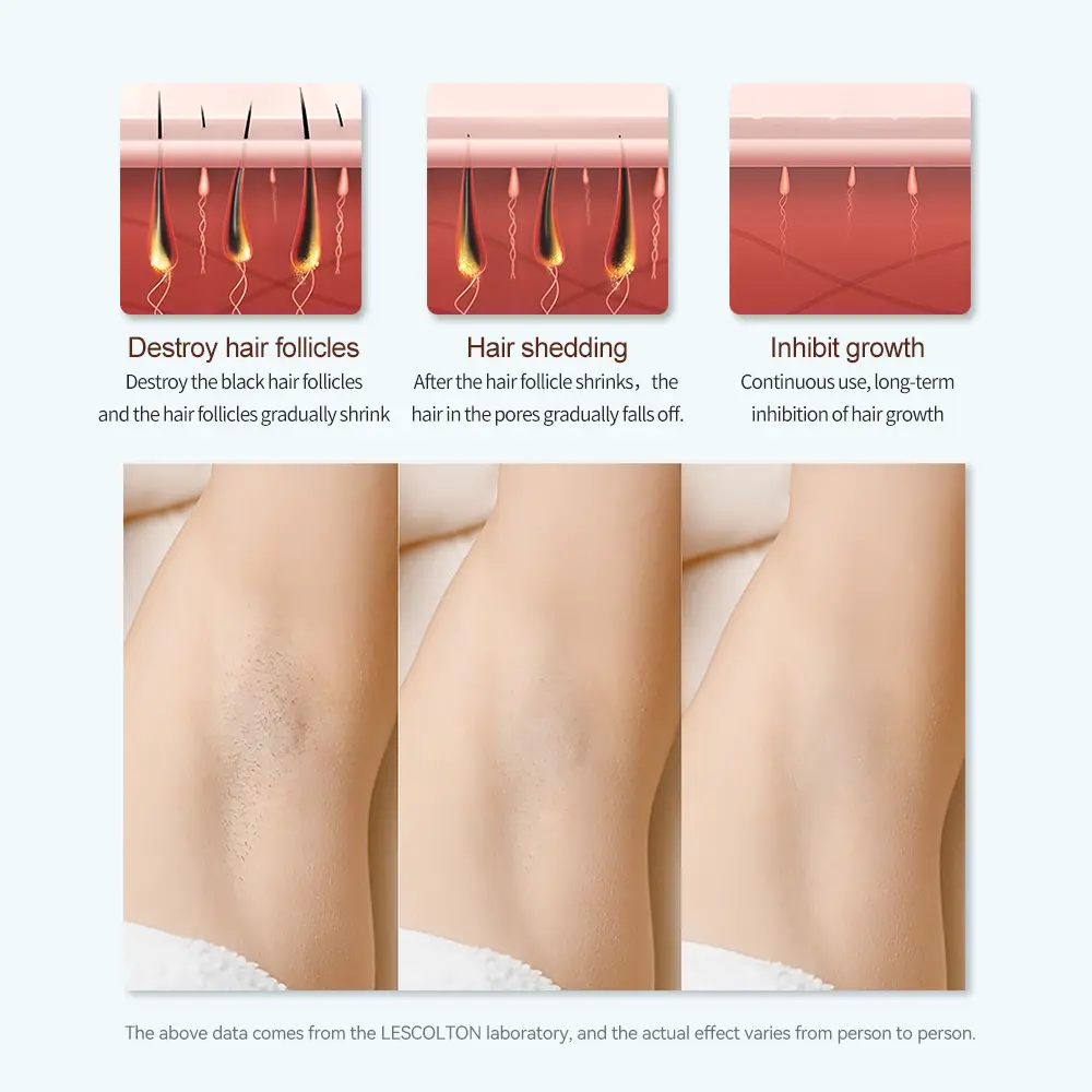 hair removal machine effect